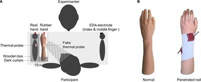 Verbal Suggestion Modulates the Sense of Ownership and Heat Pain Threshold During the “Injured” Rubber Hand Illusion